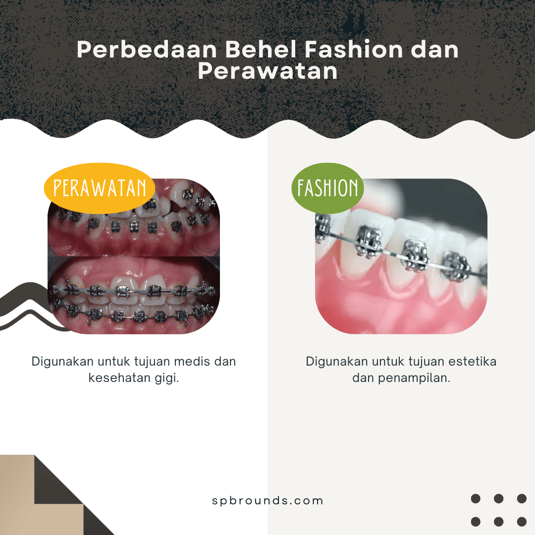 Perbedaan Behel Fashion dan Perawatan